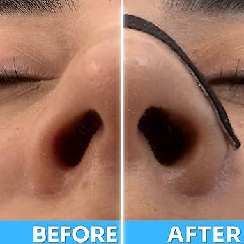 Nasal Strips by Airflow™ |Breathe Better